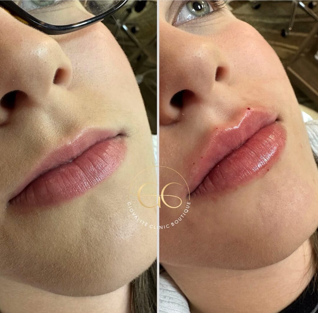 Curso-Labial-Natal 6 IMG 6038