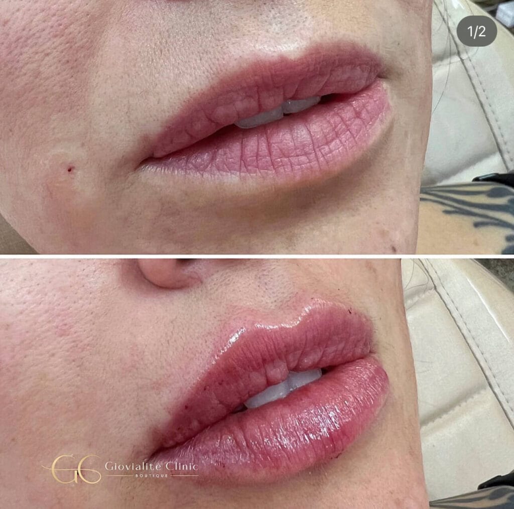 Curso-Labial-Natal 5 IMG 6040